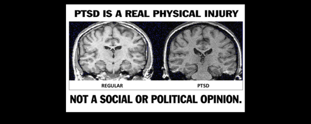 PTSD é também uma doença física!